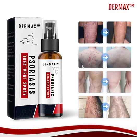 🌿 Psoriasis Spray X2 UND - ¡Alivio rápido, natural y probado!